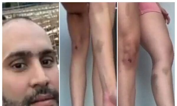 (VIDEO)Mujer fue agredida por su pareja médico forense