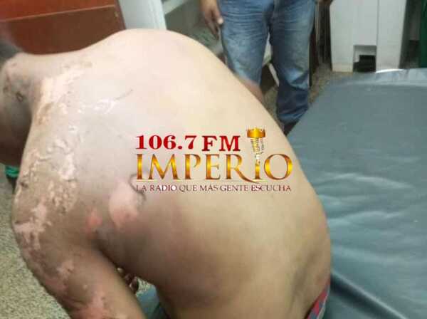 Joven sufre descarga eléctrica mientras trabajaba