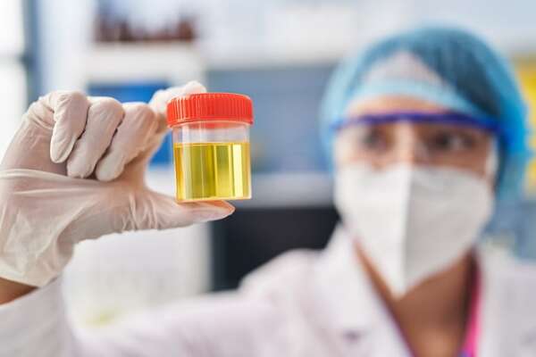 Lo que el color de la orina dice sobre tu salud - Estilo de vida - ABC Color
