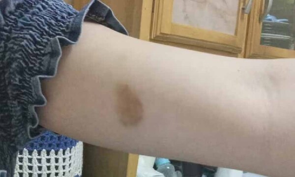 Despechado molió a golpes a su exnovia por no aceptar el fin de la relación – Prensa 5