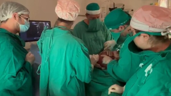 Nació bebé que fue intervenido en una cirugía intrauterina en Clínicas