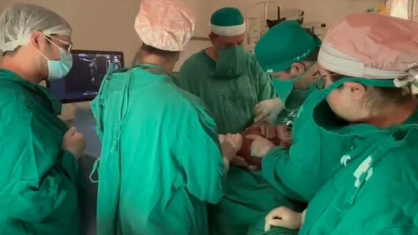 Bebé sometido a cirugía intrauterina de espina bífida nació exitosamente