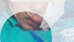 Toro embistió a niño de 9 años y lo dejó grave