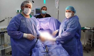 Extirpación exitosa de quiste ovárico en Hospital de Coronel Oviedo – Prensa 5