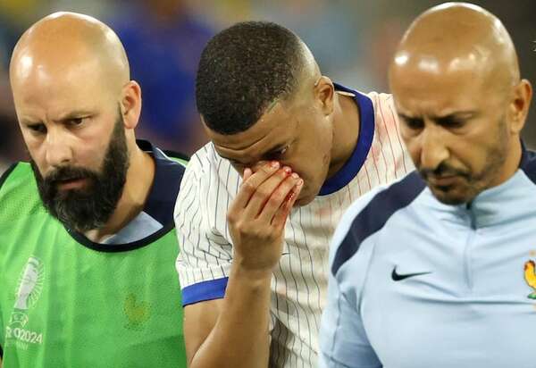 Mbappé sufre fractura de nariz - Fútbol Internacional - ABC Color