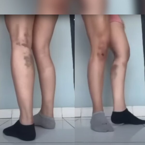 Por depilarse, mujer habría sido agredida por su pareja