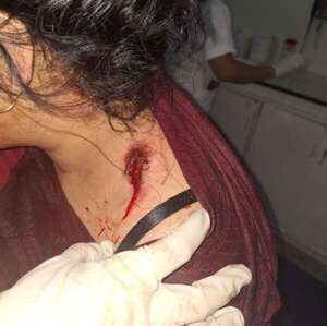 Intento de feminicidio en Villa Hayes - Policiales - ABC Color