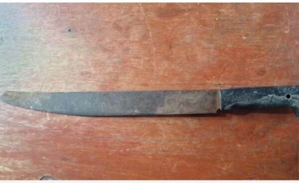 Niño de 13 años recibió machetazo en la cabeza y está grave