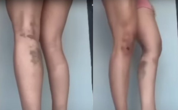 Por depilarse, mujer fue golpeada brutalmente por su pareja - Noticiero Paraguay