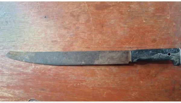 Niño de 13 años recibió machetazo en la cabeza y está grave - Noticiero Paraguay