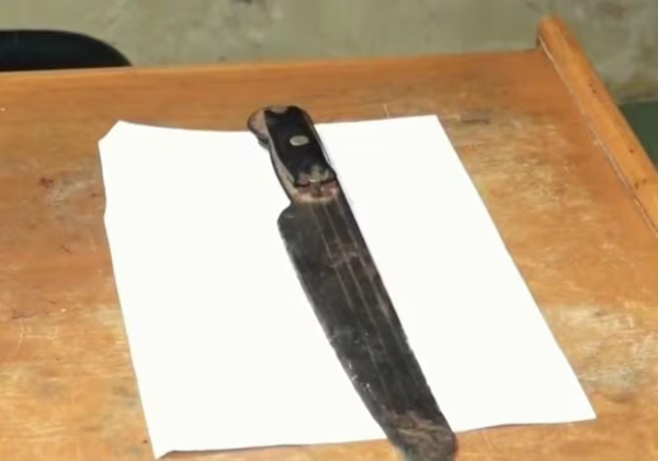 Niño de 13 años internado en estado grave tras ser macheteado en la cabeza