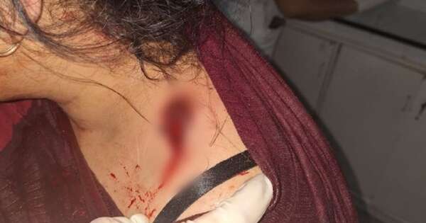 Diario HOY | Intento de feminicidio en Villa Hayes: quiso asesinar a su ex a balazos
