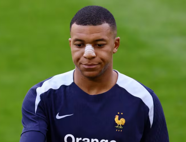 La primera imagen de Kylian Mbappé después de fracturarse la nariz en la selección de Francia