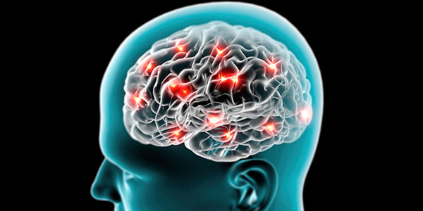 Especialista afirma que complicaciones de la neuropediatría cambiaron radicalmente - Megacadena - Diario Digital