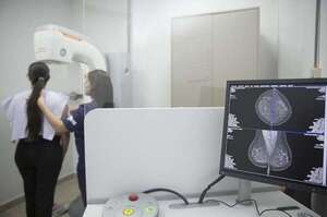 INCAN incorporará 30 mamógrafos con los que se podrán hacer 600.000 diagnósticos para la prevención del cáncer - Nacionales - ABC Color