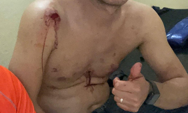 Prisión preventiva para hombre que habría intentado matar a dos en fiesta popular de Yhú - OviedoPress