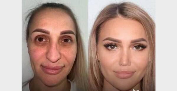 ¡Necesita nueva cédula! Se hizo armonización facial y es otra
