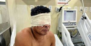¡De terror! Un hombre con esquizofrenia se arrancó los ojos
