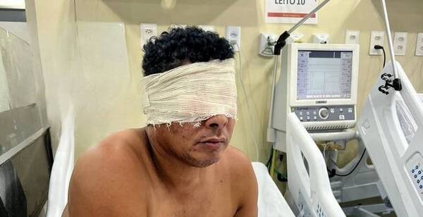 ¡De terror! Un hombre con esquizofrenia se arrancó los ojos