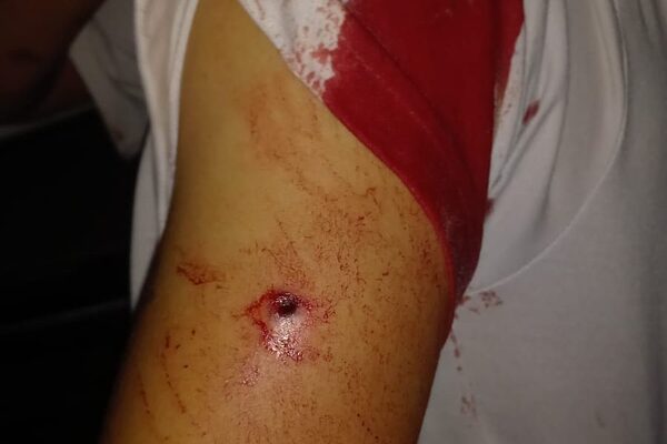 Asaltan y balean a moto bolt en CDE