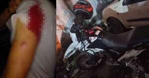 Diario HOY | Conductor de moto Bolt fue asaltado y baleado por “falso pasajero” en CDE