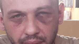 Le molieron a golpes a preso rapái por una feroz deuda en Pedro Juan