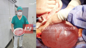 EXTRAEN QUISTE DE OVARIO GIGANTE EN EL IPS DE CNEL. BOGADO - Itapúa Noticias