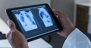 La Nación / Implementarán tecnología 3D en precirugía de lesión