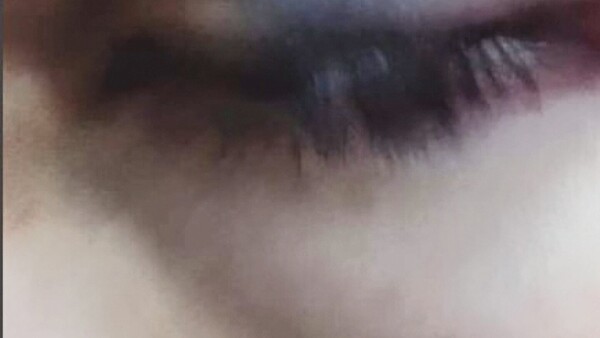 Con el ojo morado le dejó a su compañero