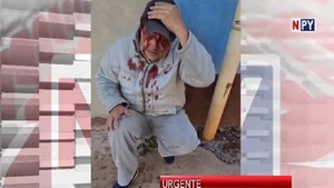 Hirieron a periodista durante cobertura de violento desalojo - Noticias Paraguay