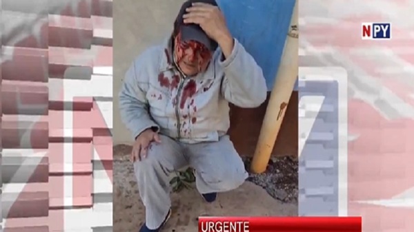 Hirieron a periodista durante cobertura de violento desalojo - Noticias Paraguay