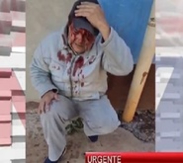 Hirieron a periodista durante cobertura de violento desalojo - Paraguay.com