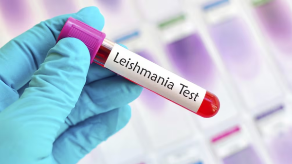 Leishmaniasis Visceral: autoridades sanitarias advierten sobre síntomas y riesgos