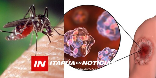 AUTORIDADES SANITARIAS INTERVIENEN TRAS SOSPECHA DE MUERTE POR LEISHMANIASIS - Itapúa Noticias