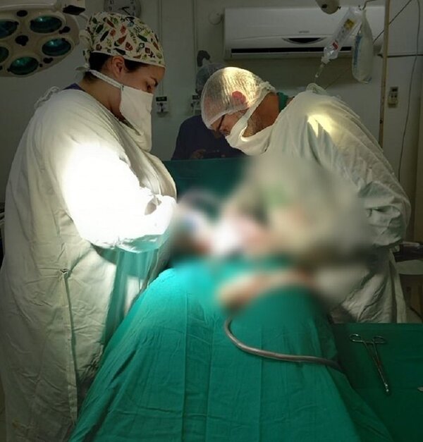 Misiones: extraen tumor de más de 5 kilos a una joven