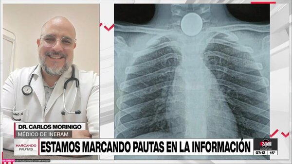 Extrajeron moneda de mil guaraníes que tragó un niño de seis años en Limpio - Megacadena - Diario Digital