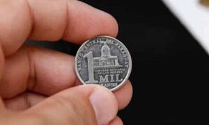 Médicos del Ineram asisten a niños que tragó una moneda de G. 1.000 – Prensa 5