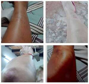Itauguá: mujer denuncia violencia sistemática por parte de su pareja - Policiales - ABC Color