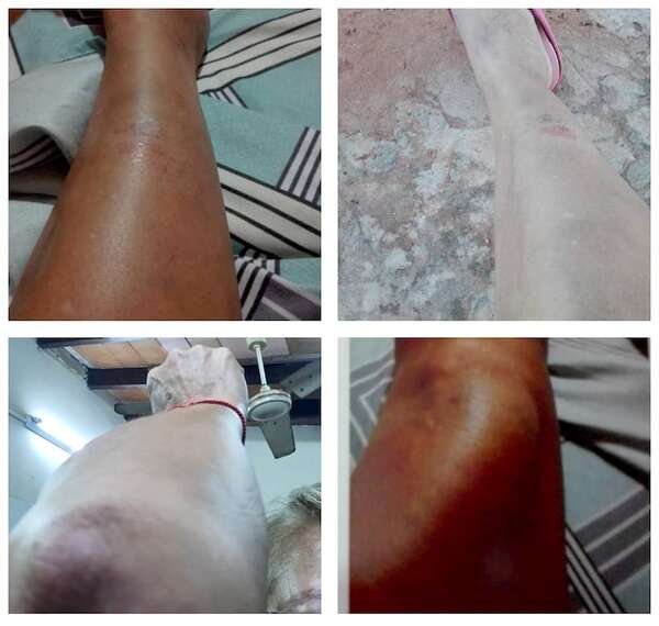Itauguá: mujer denuncia violencia sistemática por parte de su pareja - Policiales - ABC Color