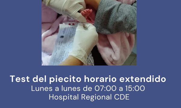 Test de piecito se realiza de lunes a lunes en Hospital Regional de CDE