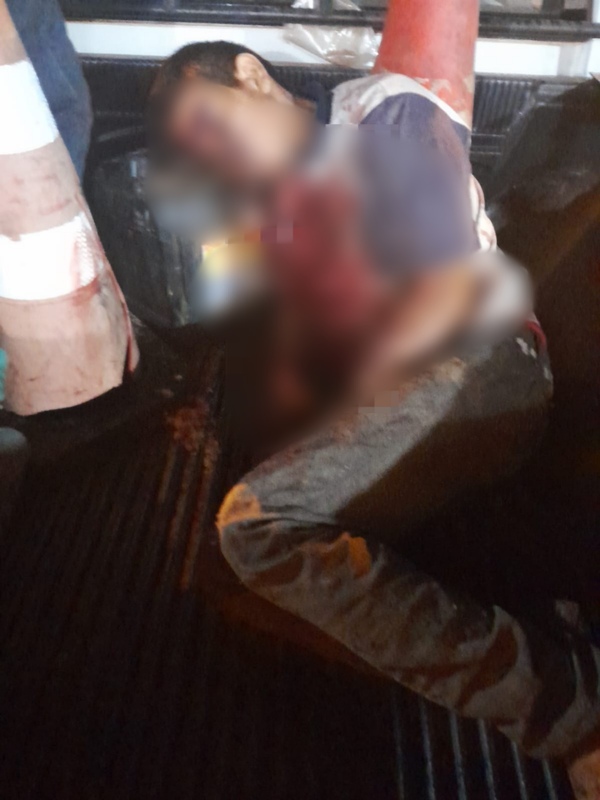 Pelea entre nativos deja a joven gravemente herido en Yby Yaú
