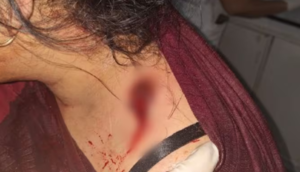 Atrapan a  un ex convicto por un intento de feminicidio