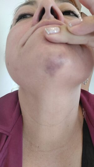 Denuncias por violencia familiar aumentaron en 16% en el primer semestre