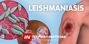 HOMBRE FALLECIDO EN CNEL. BOGADO TENÍA LEISHMANIASIS PERO NO FUE LA CAUSA DE LA MUERTE - Itapúa Noticias