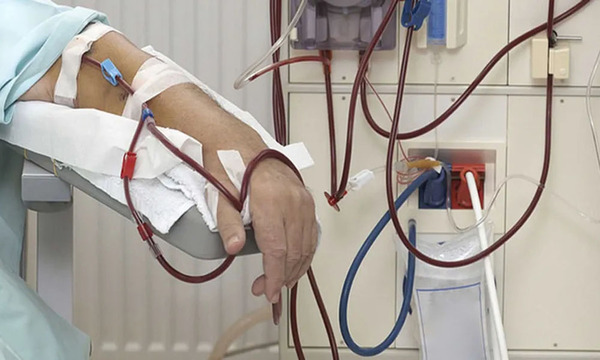 Suspenden servicio de ambulancias a pacientes dializados en el IPS - OviedoPress