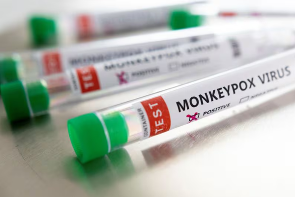 Nueva cepa de la viruela del mono pone en alerta a la OMS