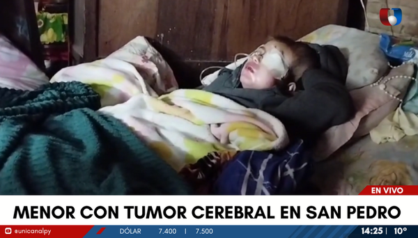 San Pedro: Madre pide ayuda para salvar la vida de su hijo que padece tumor cerebral - Unicanal