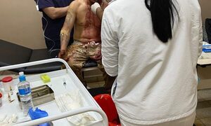 Machetean a hombre tras discusión con su tío en Cedrales