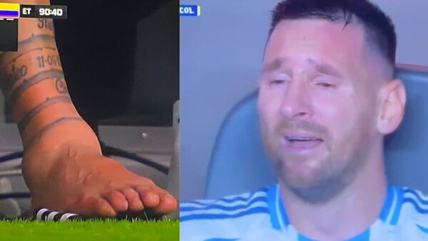 Así quedó el tobillo de Leo Messi tras lesionarse