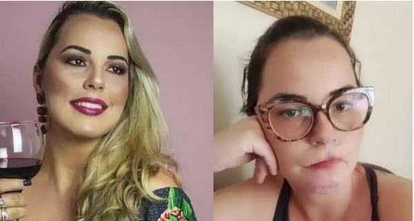 ¡Socorro! Influencer quedó sin labios luego de una armonización facial